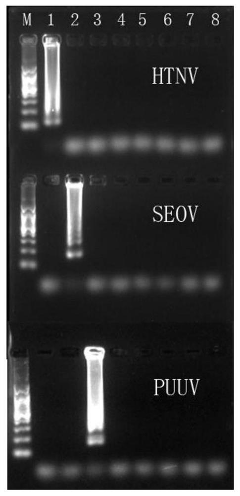 用于檢測漢坦病毒的檢測引物、檢測試劑盒及檢測方法